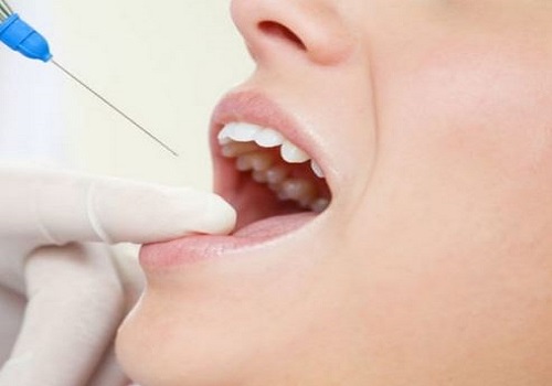 سرنگ دندان