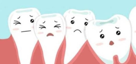 شلوغی دندان