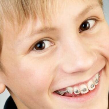 ارتودنسی دندان کودکان