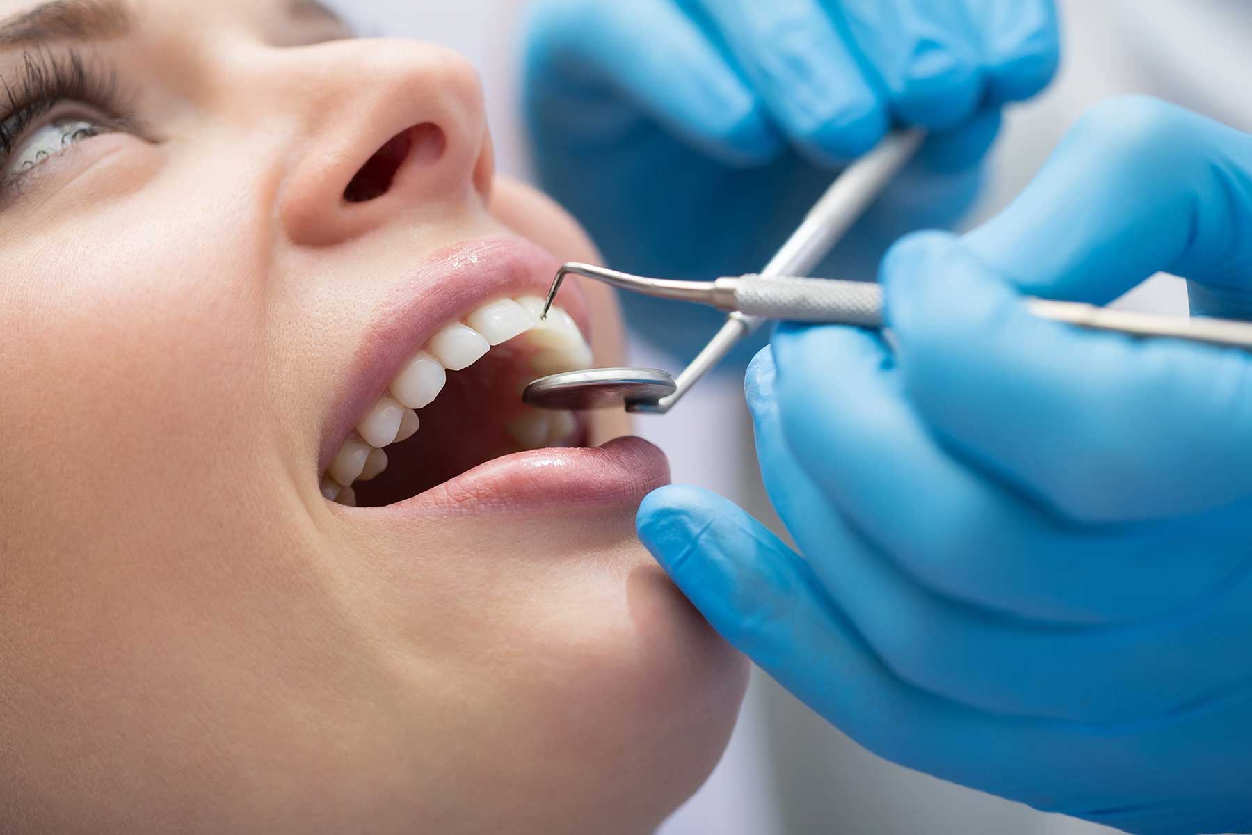 Dental aesthetic restoration