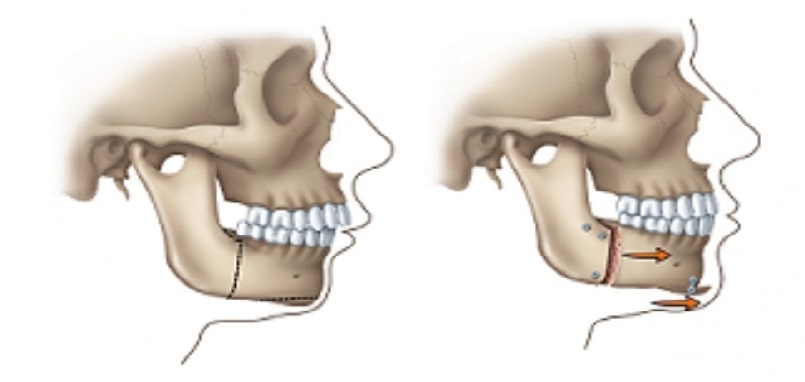 پاتولوژی (آسیب شناسی) دهان و دندان