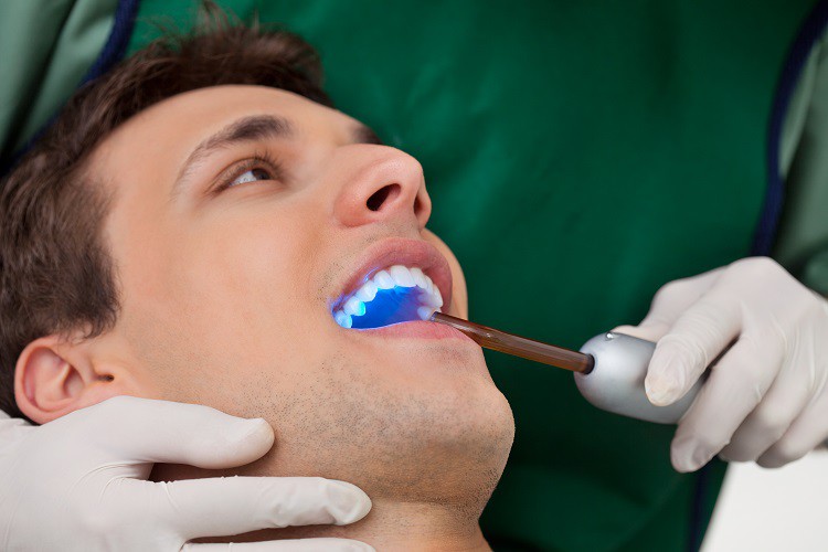باندینگ دندان چیست ؟ همه چیز درباره باندینگ دندان - ایمپلنت دندان،‌ متخصص ایمپلنت، کامپوزیت دندان، بلیچینگ دندان، ارتودنسی دندان، لمینت دندان | کلینیک دندانپزشکی مبین