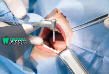 تجهیزات جراحی ایمپلنت دندانی چیست و چه وسایلی ضروری هستند؟