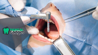 تجهیزات جراحی ایمپلنت دندانی چیست و چه وسایلی ضروری هستند؟