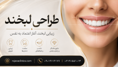 طراحی لبخند چیست؟ آشنایی با روشها، مراحل و مزایای اصلاح طرح لبخند