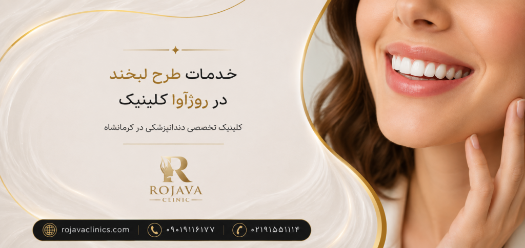 اصلاح طرح لبخند در rojavaclinics.com کلینیک تخصصی دندانپزشکی در کرمانشاه