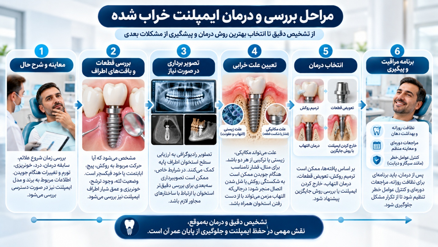مراحل درمان ایمپلنت خراب شده برای جلوگیری از پایان عمر ایمپلنت