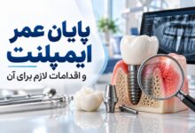 بعد از پایان عمر ایمپلنت چه باید کرد؟ راهنمای تشخیص، ترمیم و جایگزینی ایمپلنت دندان